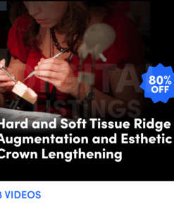 Hard and Soft Tissue Ridge Augmentation and Esthetic Crown Lengthening