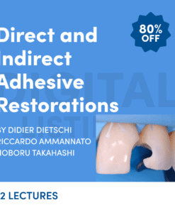 Direct and Indirect Adhesive Restorations