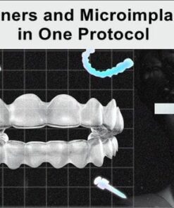Aligners and Microimplants in One Protocol