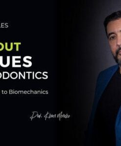 All About Torques In Orthodontics