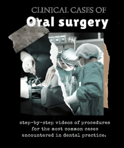 Clinical Cases of Oral Surgery
