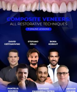 Composite Veneers: All Restorative Techniques