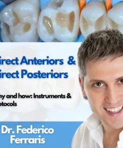 Direct Anteriors and Direct Posteriors – Why and how: instruments and protocols