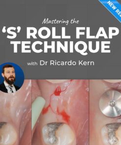 The S Roll Flap Technique