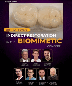 Indirect Restoration in the Biomimetic Concept