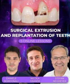 Surgical Extrusion and Replantation of Teeth