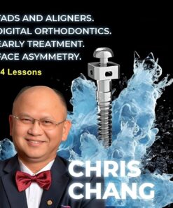 TADs and aligners, Digital orthodontics, Early treatment, Face asymmetry
