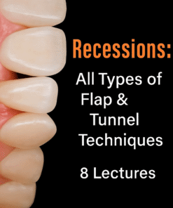 Recessions: All Types of Flap & Tunnel Techniques