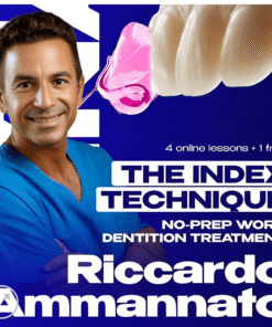 The Index Technique. No-prep Worn Dentition Treatment
