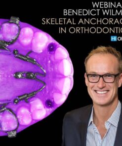 Skeletal Anchorage in Orthodontics: Challenging Orthodontic Cases