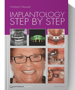 Implantology Step by Step 1st Edition
