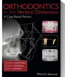 Orthodontics in the Vertical Dimension: A Case-Based Review 1st Edition