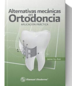 Alternativas mecánicas en ortodoncia. Aplicación práctica
