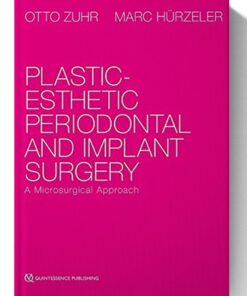 Plastic-Esthetic Periodontal and Implant Surgery: A Microsurgical Approach 1st Edition (SCANNED)