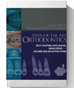 State-of-the-Art Orthodontics E-Book 1st Edition