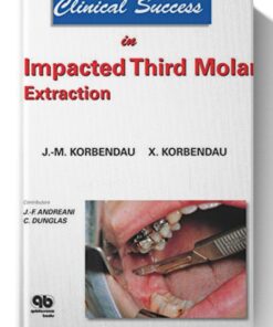 Clinical Success in Impacted Third Molar Extraction