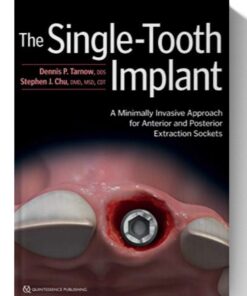 The Single-Tooth Implant: A Minimally Invasive Approach for Anterior and Posterior Extraction Sockets 1st Edition