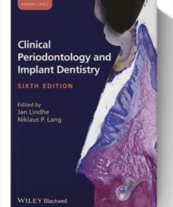 Clinical Periodontology and Implant Dentistry, 2 Volume Set 6th Edition