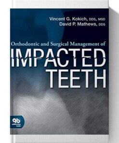 Orthodontic and Surgical Management of Impacted Teeth First Edition