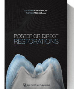 Posterior Direct Restorations 1st Edition