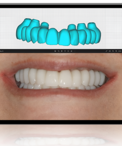 EXOCAD BÁSICO: Modelos, Coronas, Férulas, Coronas sobre implantes, AOX y más