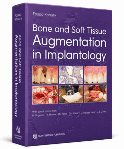 Bone and Soft Tissue Augmentation in Implantology