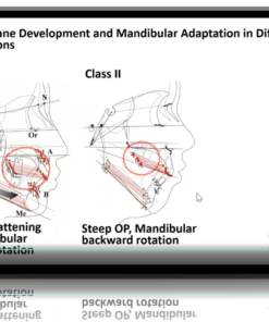 Diploma en Ortodoncia Neuromuscular Clínica y Funcional